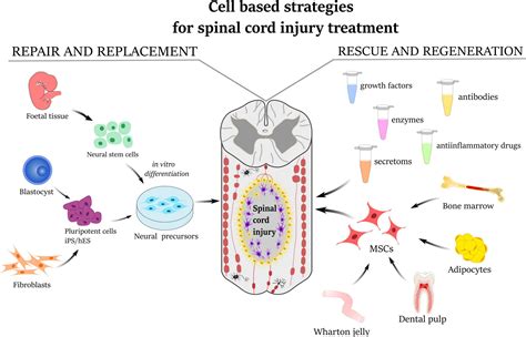 【メーカー再生品】 SPINAL CORD INJURY bourd review asakusa.sub.jp