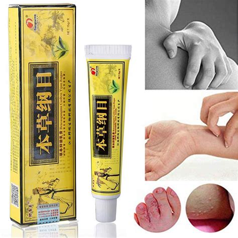 Buy High Quality Chinese al Eczema, Psoriasis Creams Dermatitis and ...