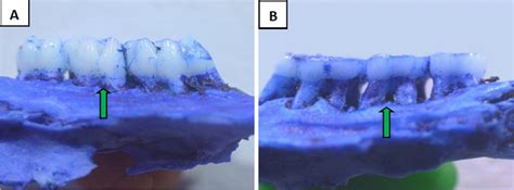 Methylene blue staining of periodontal tissues(Original magnification ...