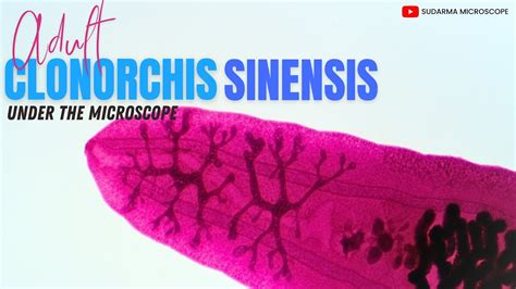 Adult Clonorchis sinensis under the microscope - YouTube