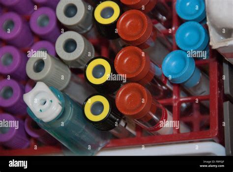 Lab equipment hi-res stock photography and images - Alamy