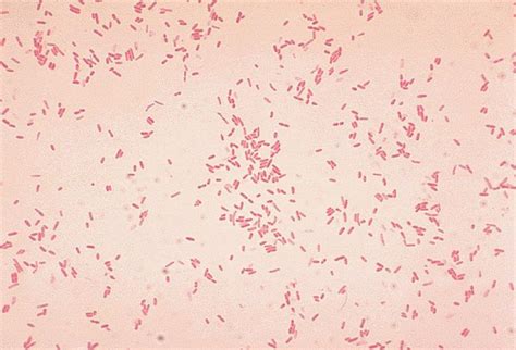 gram negative coccobacilli | Bacteria, gram negative bacilli, glucose ...