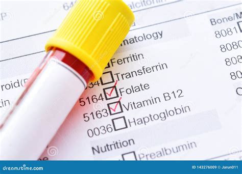 Blood Sample for Vitamin B12 and Folate Test Stock Image - Image of ...