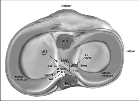 —anatomy of posterior roots. Mte: medial tibial eminence; lte: lateral ...