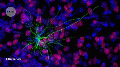 How stem cells make a human brain