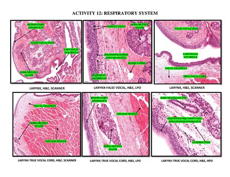 Histopathology- Respiratory System - LARYNX, H&E, SCANNER LARYNX-FALSE ...