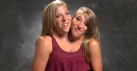 Abby and Brittany Hensel: The world's most famous conjoined twins are ...