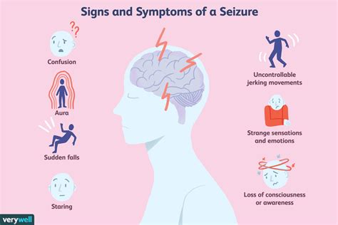 Seizures - Symptoms, Causes & Treatment - Santripty