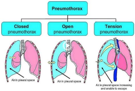 Redirecting in 2021 | Medical school studying, Nursing mnemonics, Emt study