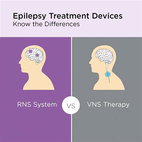 Epilepsy Treatment Devices: RNS and VNS | information | Know some of ...