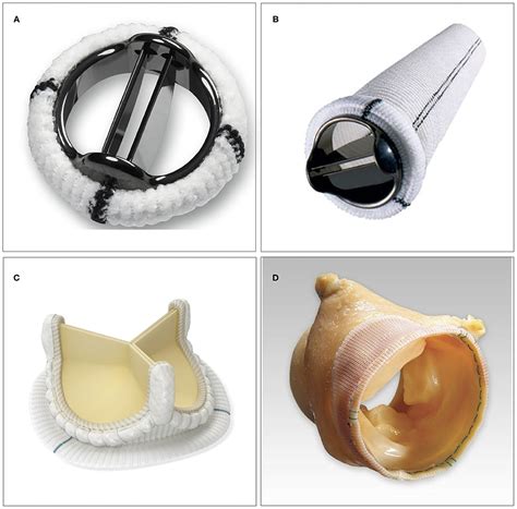 Mechanical Aortic Valve Replacement