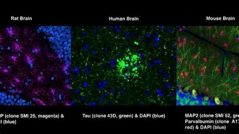 Immunofluorescence tissue staining | Technology Networks