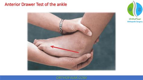 Anterior Drawer Test Of The Ankle | OrthoFixar 2024