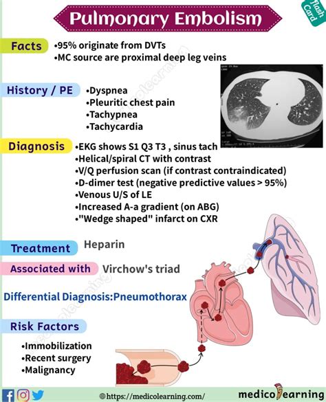 Pulmonary Embolism Causes