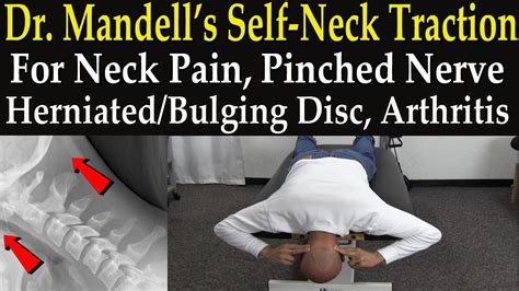 What Does A Pinched Nerve In Your Neck Feel Like - Expert's answers for ...