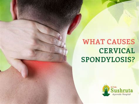 Spondylosis Treatment | Sushruta Ayurveda Hospital