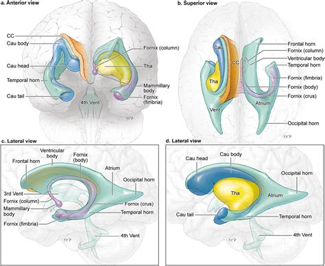 Ventricular Occipital Horn