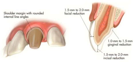 Full Coverage Prep Guide