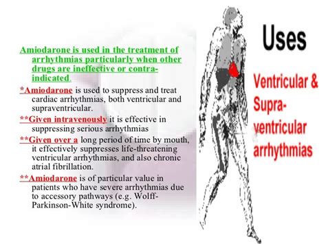 Amiodarone