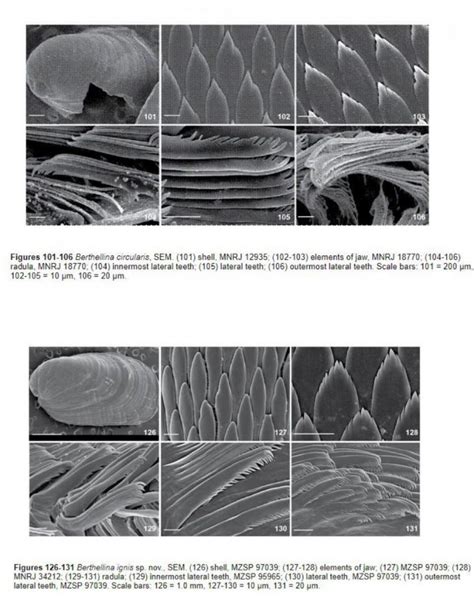 Phylum: Mollusca & their radula | Cephalopod Radula under the SEM