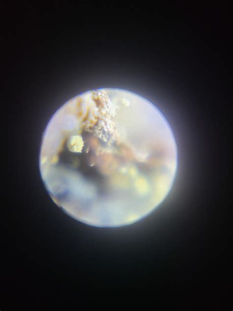 Are these fungus gnat eggs? (Microscope pictures attached) : r/houseplants