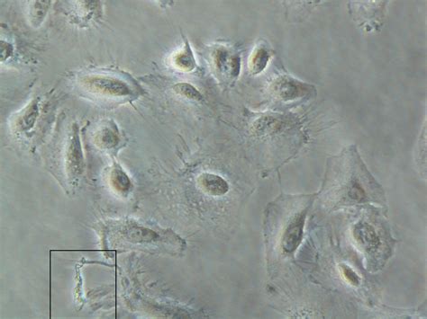 Mycoplasma Contamination Cell Culture