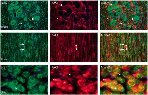 Differences in pituitary adenylate cyclase-activating peptide and ...