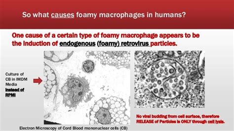 Atherosclerosis: New Insights on Foamy Macrophage Induction and Persi…