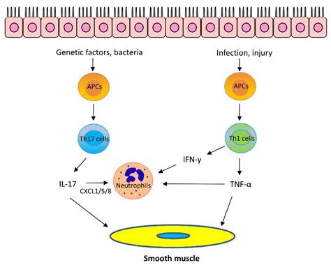 Cells | Free Full-Text | Current Understanding of Asthma Pathogenesis ...