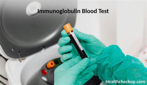 Immunoglobulin Blood Test: Purpose, Preparation, Procedure