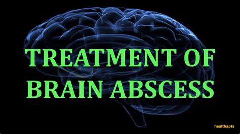 TREATMENT OF BRAIN ABSCESS - YouTube