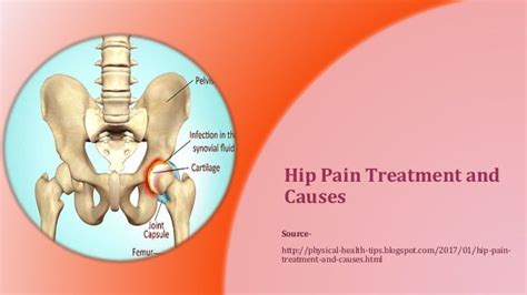 Hip pain treatment and causes