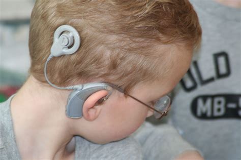 FDA approves a remote feature to cochlear implant system (With images ...