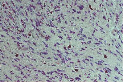 Connective Tissue Histology - Mast cells - histology slide