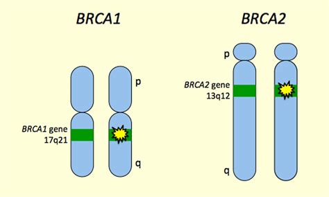 Potential interactions between Brca1 or Brca2 gene defects and DES exposure