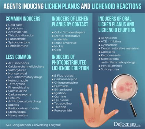 Lichen Planus: Symptoms, Causes and Support Strategies