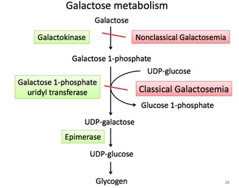 Inherited metabolic disorders Galactose Metabolism Flashcards | Quizlet