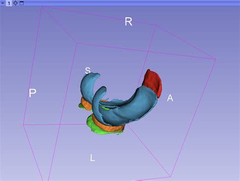 3D Visualization Method in Slicer - Support - 3D Slicer Community