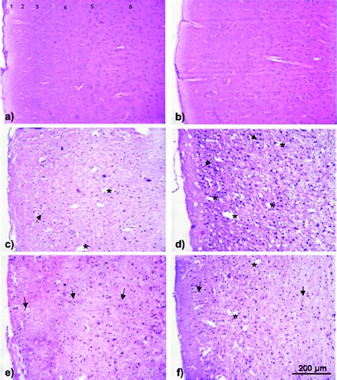 Layers Of Cerebral Cortex Histology