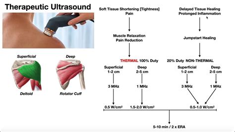 Therapeutic Ultrasound EXPLAINED | Use, Parameters, & Real Example ...