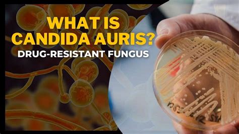 What Is Candida auris? A Drug-Resistant Fungus. All You Need To Know