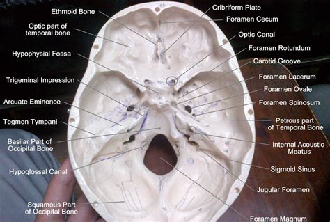 Foramen rotundum - - Image Search Results Skull Anatomy, Human Anatomy ...