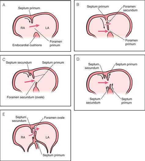 Diagram Of The Heart Septum