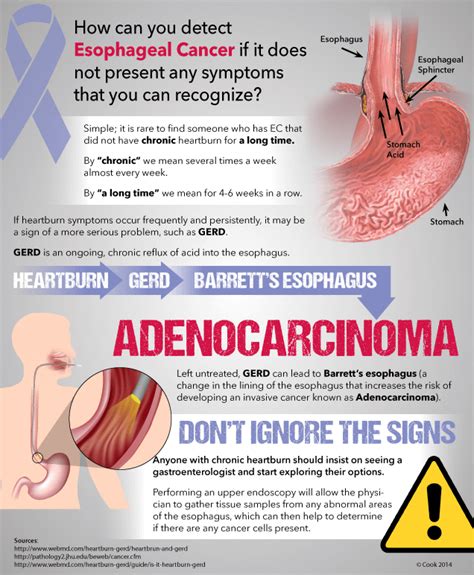 How can you detect Esophageal Cancer? | Endoscopy