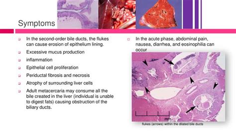 PPT - Clonorchis sinensis PowerPoint Presentation - ID:1158357