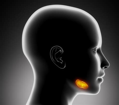 salivary-gland-infection-in-sublingual-gland[1]