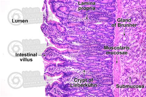 Histology Small Intestine Duodenum Histology Small In Vrogue Co ...