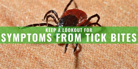 How To Treat Tick Bites