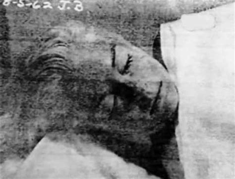 Marilyn Monroe autopsy photo (#2) - Weird Picture Archive