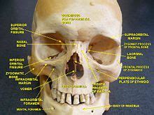 Bone Fissure